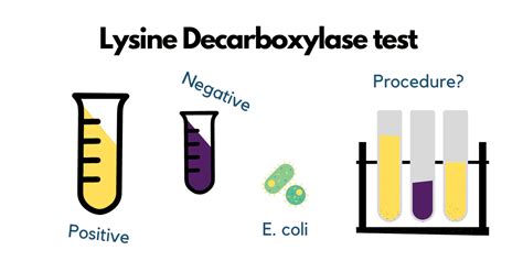 lysine decarboxylase test